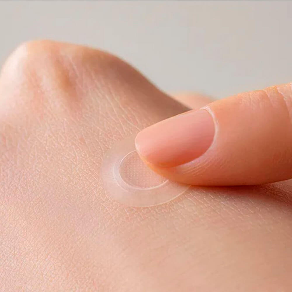 Противовоспалительные патчи с микроиглами Some By Mi﻿ Micro Pin Spot Patch