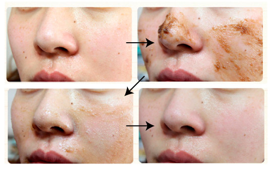 Маска-эксфолиант с черным сахаром Skinfood Black Sugar Mask Wash Off