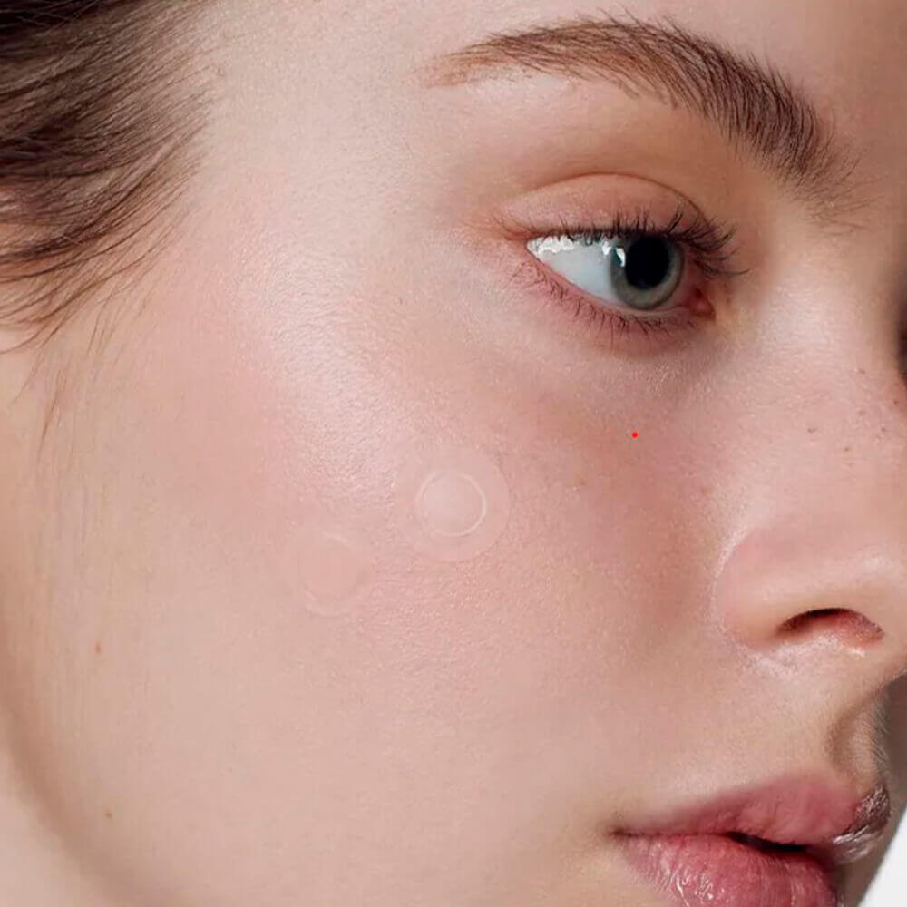 Противовоспалительные патчи с микроиглами Some By Mi﻿ Micro Pin Spot Patch