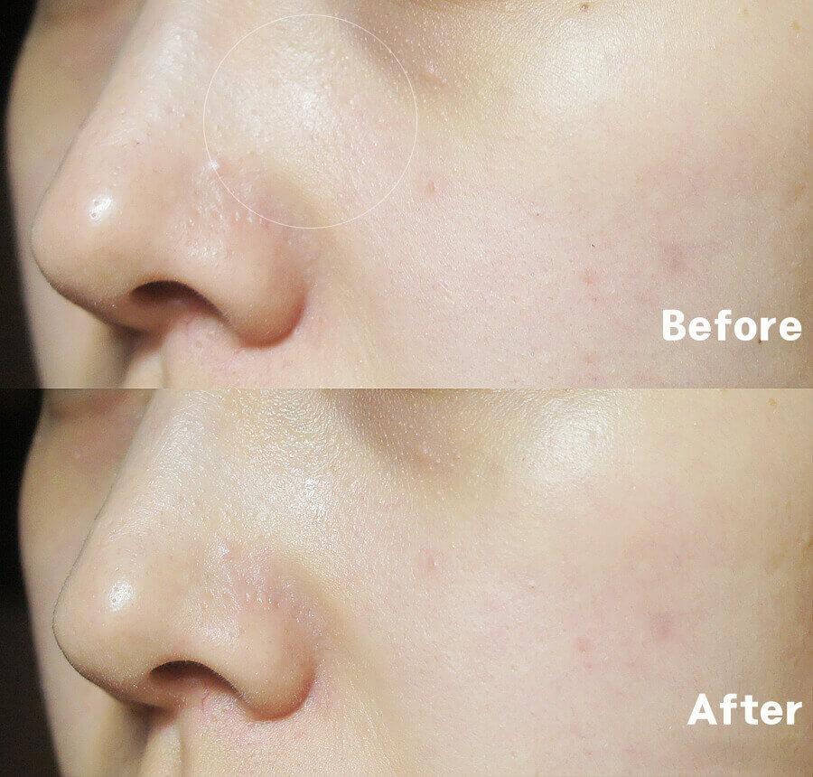 Тоник для сужения пор Etude House Wonder Pore Freshner