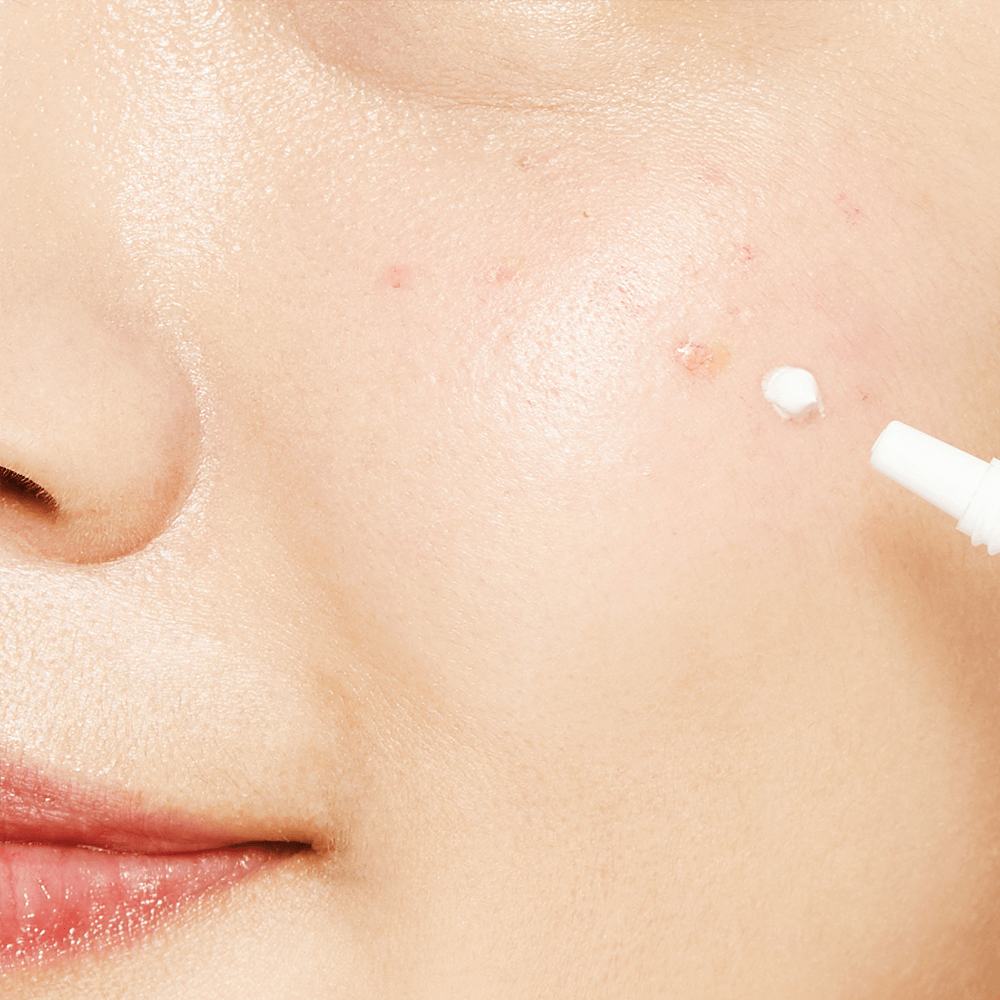 Лечебный локальный крем против акне COSRX AC Collection Ultimate Spot Cream