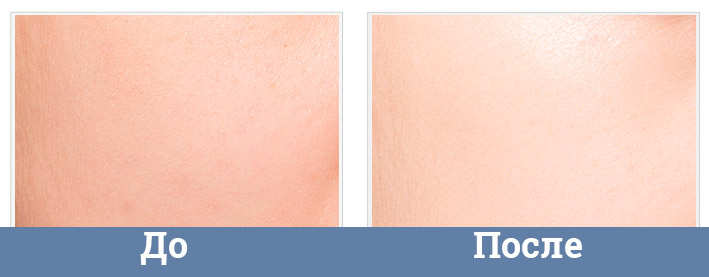 CC-крем с маслом чайного дерева для проблемной и жирной кожи Apieu Nonco Tea Tree Tinted CC Cream