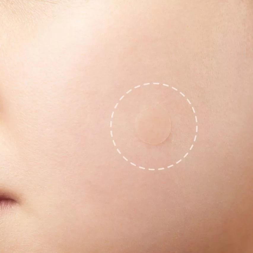 Наклейки против прыщей Elizavecca Witch Piggy Hell-Pore Blemish Spot Patch