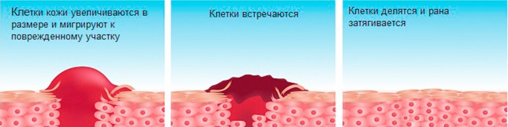 Инфографика