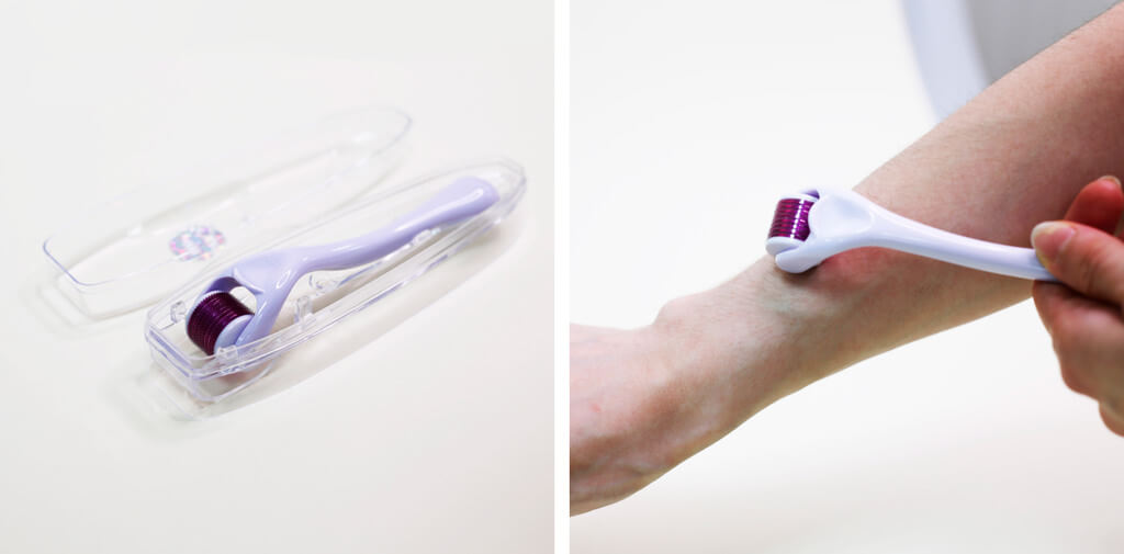 Мезороллер Мезороллер